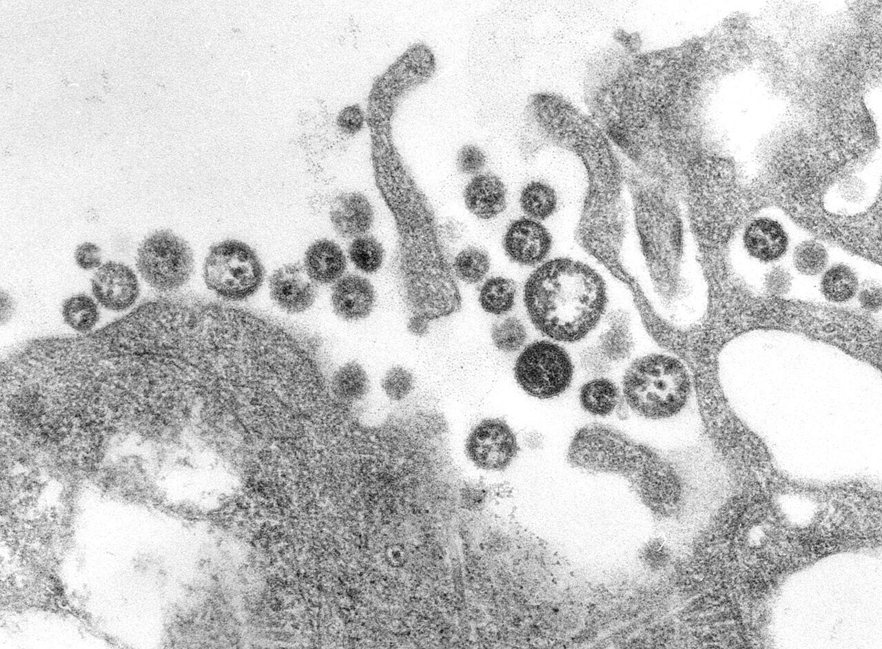Electron micrograph showing Lassa virus particles